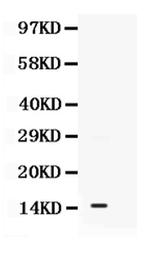 S100A11 Antibody in Western Blot (WB)