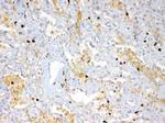 S100A7 Antibody in Immunohistochemistry (Paraffin) (IHC (P))