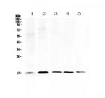 S100A7 Antibody in Western Blot (WB)