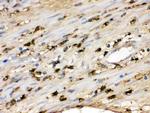 S100A9 Antibody in Immunohistochemistry (Paraffin) (IHC (P))