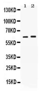 SCTR Antibody in Western Blot (WB)