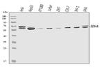 SDHA Antibody in Western Blot (WB)