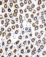 SDHC Antibody in Immunohistochemistry (Paraffin) (IHC (P))