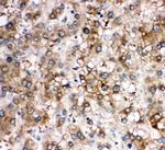 SERPINA6 Antibody in Immunohistochemistry (Paraffin) (IHC (P))