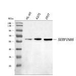 SERPINA6 Antibody in Western Blot (WB)