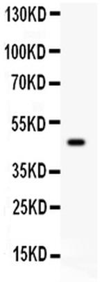 SERPINB2 Antibody in Western Blot (WB)