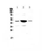 PAI1 Antibody in Western Blot (WB)