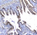 SF1 Antibody in Immunohistochemistry (Paraffin) (IHC (P))