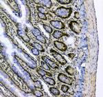 SF1 Antibody in Immunohistochemistry (Paraffin) (IHC (P))