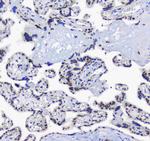 SF1 Antibody in Immunohistochemistry (Paraffin) (IHC (P))