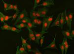 SF1 Antibody in Immunocytochemistry (ICC/IF)