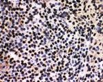 SF1 Antibody in Immunohistochemistry (Frozen) (IHC (F))