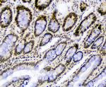 SF1 Antibody in Immunohistochemistry (Paraffin) (IHC (P))