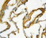 SFTPA1 Antibody in Immunohistochemistry (Paraffin) (IHC (P))