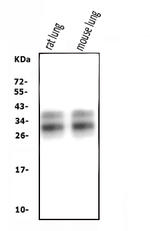 SFTPA1 Antibody in Western Blot (WB)