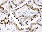 SFTPD Antibody in Immunohistochemistry (Paraffin) (IHC (P))