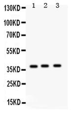 SFTPD Antibody in Western Blot (WB)