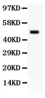 SGK1 Antibody in Western Blot (WB)