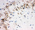 SHH Antibody in Immunohistochemistry (Paraffin) (IHC (P))