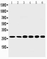 SHH Antibody in Western Blot (WB)