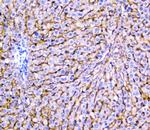 NTCP Antibody in Immunohistochemistry (Paraffin) (IHC (P))