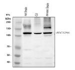 SLC12A6 Antibody in Western Blot (WB)