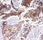 SLC16A4 Antibody in Immunohistochemistry (Paraffin) (IHC (P))