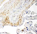 SLC16A4 Antibody in Immunohistochemistry (Paraffin) (IHC (P))