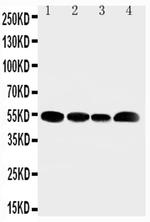 SLC16A4 Antibody in Western Blot (WB)