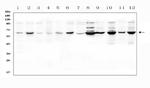 SLC19A1 Antibody in Western Blot (WB)