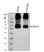 GLT-1 Antibody in Western Blot (WB)