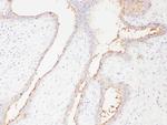 SLC22A6 Antibody in Immunohistochemistry (Paraffin) (IHC (P))