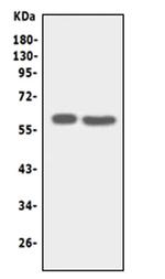 SLC22A6 Antibody in Western Blot (WB)