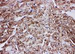 GLUT4 Antibody in Immunohistochemistry (Paraffin) (IHC (P))