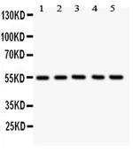 GLUT4 Antibody in Western Blot (WB)