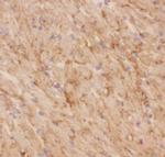 GLUT4 Antibody in Immunohistochemistry (Frozen) (IHC (F))