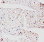 GLUT4 Antibody in Immunohistochemistry (Paraffin) (IHC (P))