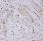 GLUT4 Antibody in Immunohistochemistry (Paraffin) (IHC (P))