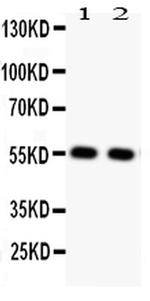 GLUT4 Antibody in Western Blot (WB)