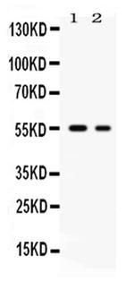 GLUT5 Antibody in Western Blot (WB)