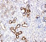 GLUT5 Antibody in Immunohistochemistry (Paraffin) (IHC (P))