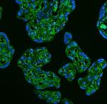 GLUT9 Antibody in Immunohistochemistry (IHC)