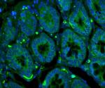 GLUT9 Antibody in Immunohistochemistry (IHC)