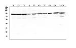 SLC6A4 Antibody in Western Blot (WB)