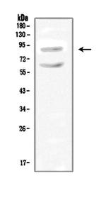 SLC9A2 Antibody in Western Blot (WB)