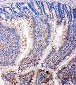 SMAD5 Antibody in Immunohistochemistry (Paraffin) (IHC (P))