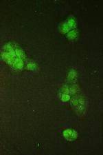 SMC6 Antibody in Immunocytochemistry (ICC/IF)