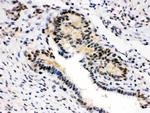 SMN1/SMN2 Antibody in Immunohistochemistry (Paraffin) (IHC (P))