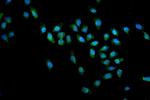 SMN1/SMN2 Antibody in Immunocytochemistry (ICC/IF)