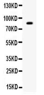 SMURF2 Antibody in Western Blot (WB)